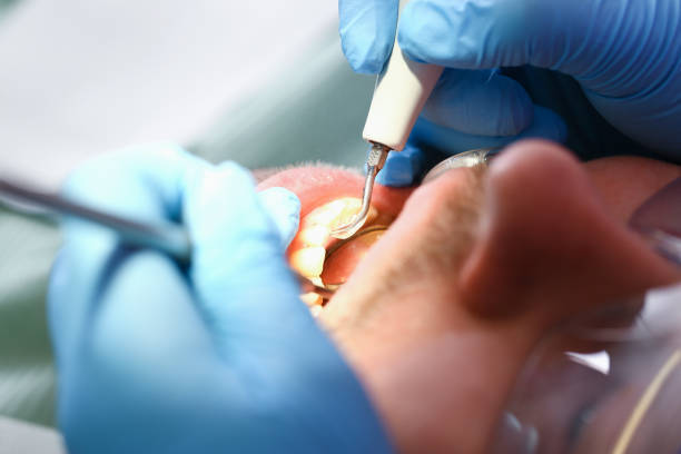 Best Same-Day Emergency Dental Services in Kennedale, TX