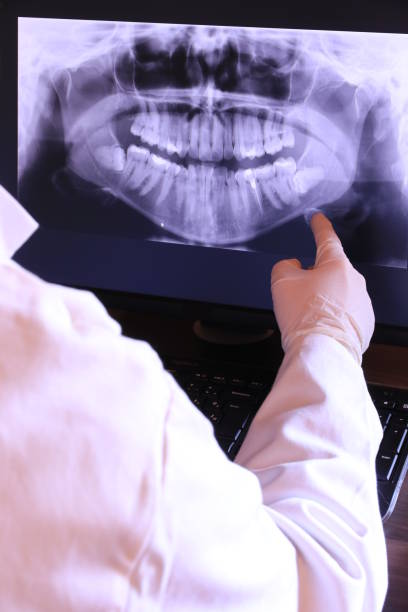 Best Emergency Gum Treatment in Kennedale, TX