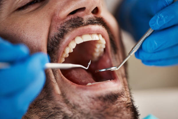 Best Emergency Gum Treatment in Kennedale, TX