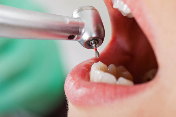 Best Emergency Denture Repair in Kennedale, TX